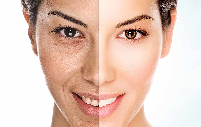 Zweigeteiltes Gesicht als Vorher-Nachher-Vergleich